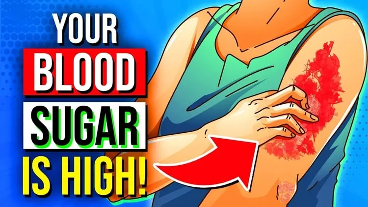 16 Signs Your Blood Sugar is High & 8 Diabetes Symptoms