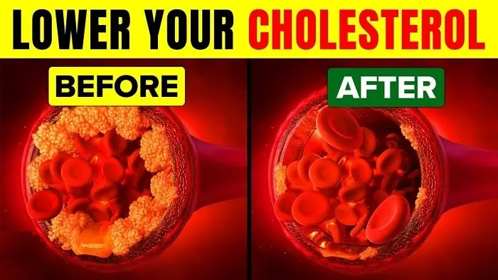8 Foods You Can Eat to Help Lower High Cholesterol